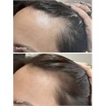 UKHAIR Hair Growth Scalp Serum - 30ml Alternative Image