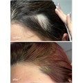UKHAIR Hair Growth Scalp Serum - 30ml Alternative Image