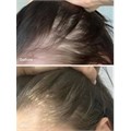 UKHAIR Hair Growth Scalp Serum - 30ml Alternative Image