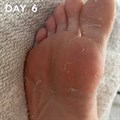 +maskology Professional Foot Peel Treatment Alternative Image