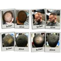 3D Hair Loss Fibres for Thinning Hair Light Blonde - 35g Alternative Image